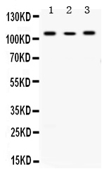 1 - Anti-Alpha Actinin 4 Picoband Antibody ABO12659
