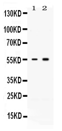 1 - Anti-ACVR2B Picoband Antibody ABO12660