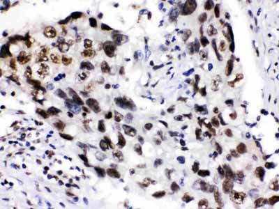 2 - Anti-ADAR1 Picoband Antibody ABO12661
