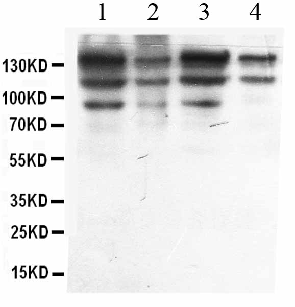 1 - Anti-ADAR1 Picoband Antibody ABO12661