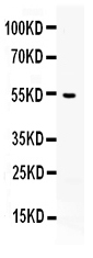 1 - Anti-AEBP2 Picoband Antibody ABO12662