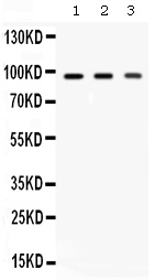 1 - Anti-Ago2/eIF2C2 Picoband Antibody ABO12663