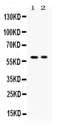 1 - Anti-AIRE Picoband Antibody ABO12665