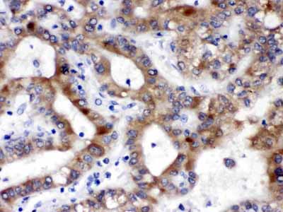 2 - Anti-ALDH3A2 Picoband Antibody ABO12667