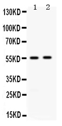 1 - Anti-ALDH3A2 Picoband Antibody ABO12667