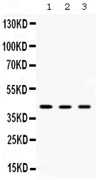 1 - Anti-AMACR Picoband Antibody ABO12668