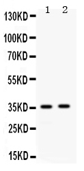 1 - Anti-APOE Picoband Antibody ABO12671