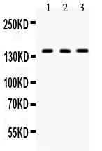 1 - Anti-Bcr Picoband Antibody ABO12673