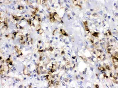 2 - Anti-ca2 Picoband Antibody ABO12674