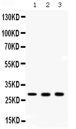 1 - Anti-ca2 Picoband Antibody ABO12674