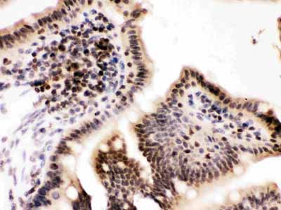2 - Anti-Cyclin T1 Picoband Antibody ABO12675