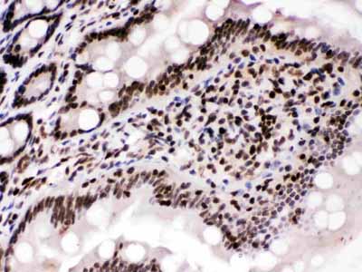 2 - Anti-Cyclin T1 Picoband Antibody ABO12675