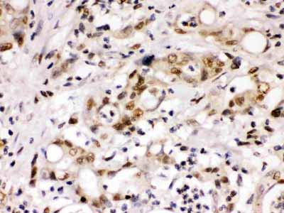 2 - Anti-Cyclin T1 Picoband Antibody ABO12675