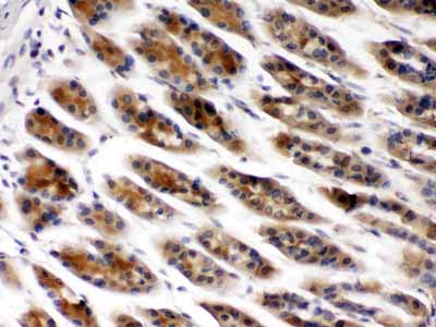 2 - Anti-TCP1 beta Picoband Antibody ABO12677