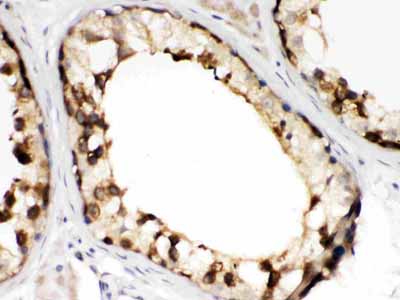 2 - Anti-TCP1 beta Picoband Antibody ABO12677