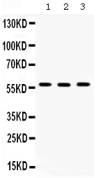 1 - Anti-TCP1 beta Picoband Antibody ABO12677