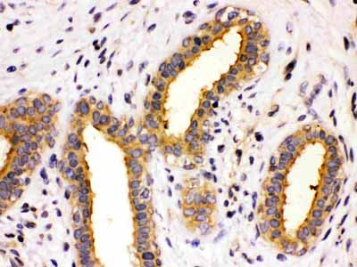 2 - Anti-TCP1 theta Picoband Antibody ABO12678