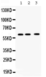 1 - Anti-TCP1 theta Picoband Antibody ABO12678