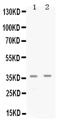 1 - Anti-Cdk6 Picoband Antibody ABO12680