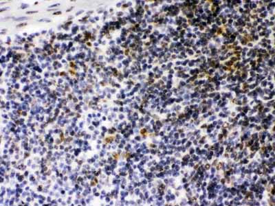 2 - Anti-CIITA Picoband Antibody ABO12681