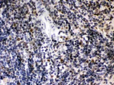 2 - Anti-CIITA Picoband Antibody ABO12681