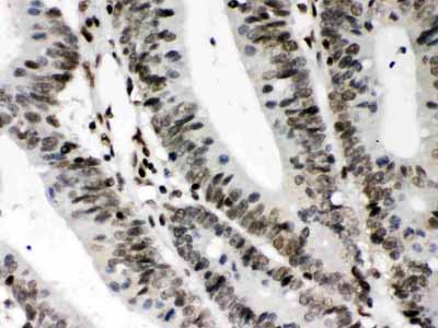 2 - Anti-CIITA Picoband Antibody ABO12681