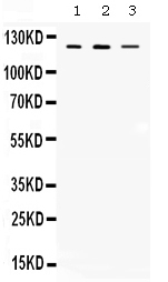 1 - Anti-CIITA Picoband Antibody ABO12681