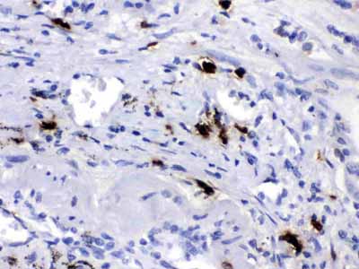 2 - Anti-TAFI/CPB2 Picoband Antibody ABO12682