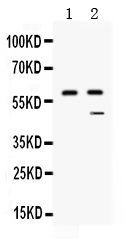 1 - Anti-TAFI/CPB2 Picoband Antibody ABO12682