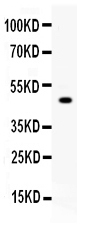 1 - Anti-TAFI/CPB2 Picoband Antibody ABO12683