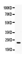 1 - Anti-IFN gamma Antibody ABO12686