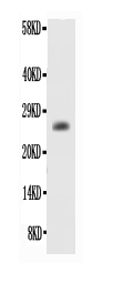 1 - Anti-human BCL-2 Antibody ABO12688