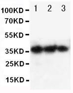 1 - Anti-EPO Antibody ABO12689