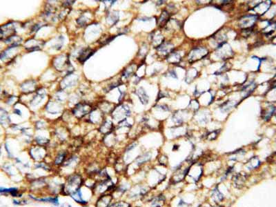 2 - Anti-FGF1 Antibody ABO12690
