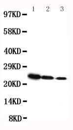1 - Anti-Growth Hormone/GH1 Antibody ABO12692