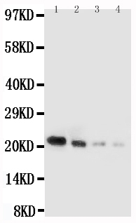 1 - Anti-IL-18 Antibody ABO12702