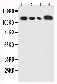 1 - Anti-CEA Antibody ABO12703