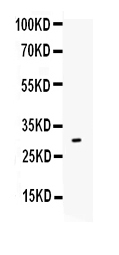 1 - Anti-IL-17 Antibody ABO12704