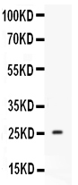1 - Anti-Prolactin Antibody ABO12706