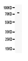 1 - Anti-human Transferrin Antibody ABO12707