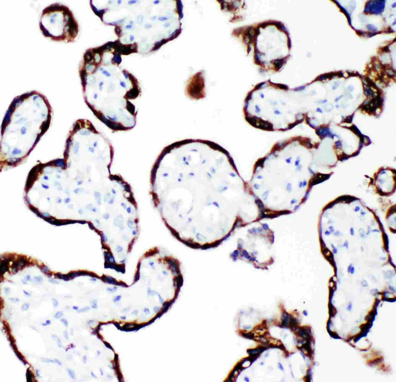 2 - Anti-Growth Hormone Antibody ABO12708