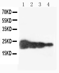 1 - Anti-Growth Hormone Antibody ABO12708