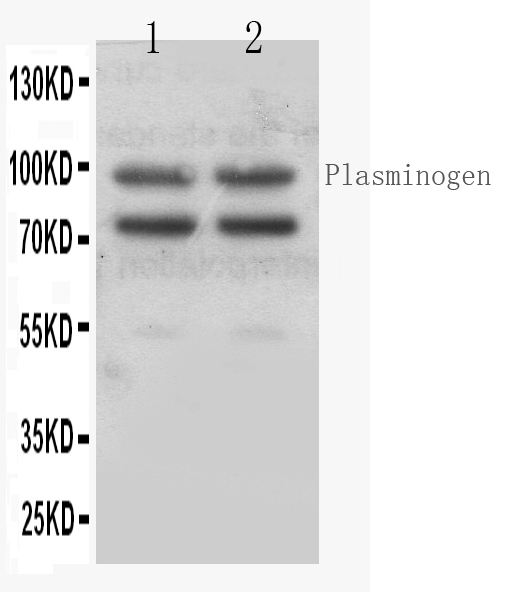 1 - Anti-Angiostatin K1-3 Antibody ABO12712