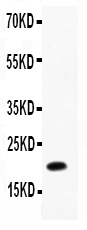 1 - Anti-IL-12(p40) Antibody ABO12713