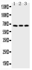 1 - Anti-CD30/TNFRSF8 Antibody ABO12714