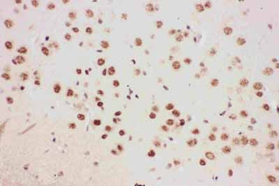 2 - Anti-ALOX5 Antibody ABO12716