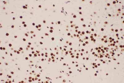 2 - Anti-ALOX5 Antibody ABO12716