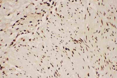 2 - Anti-ALOX5 Antibody ABO12716