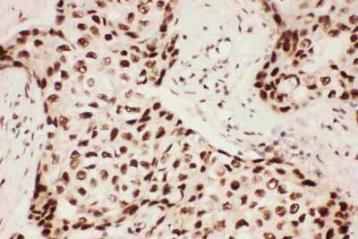 2 - Anti-ALOX5 Antibody ABO12716