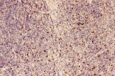 2 - Anti-FOXP3 Antibody ABO12717